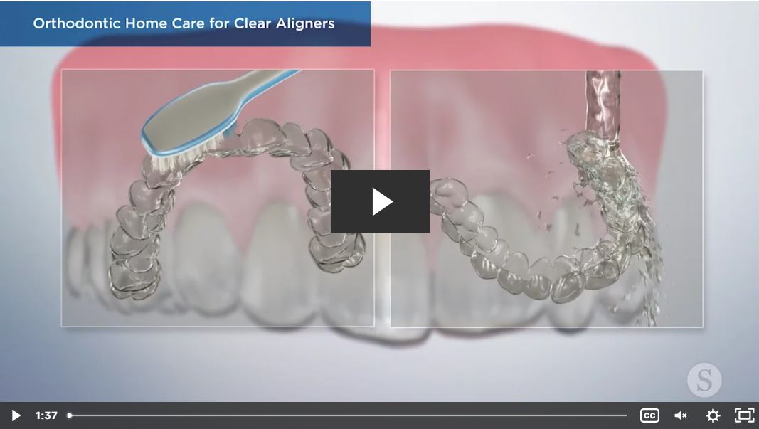 Orthodontic Home Care for Clear Aligners